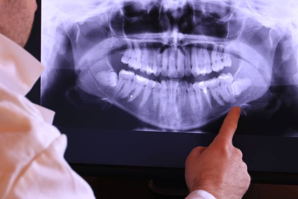 Best Emergency Tooth Extraction in South Wenatchee, WA