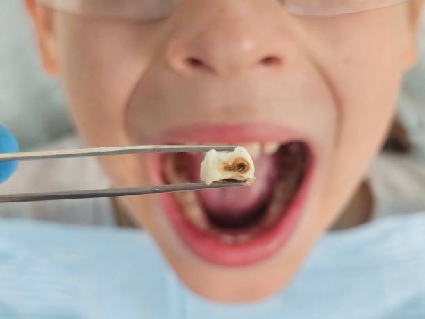 Best Cosmetic Emergency Dentistry in South Wenatchee, WA